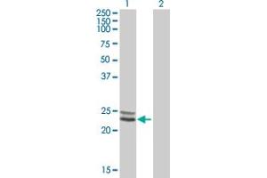 Western Blot analysis of NDUFV2 expression in transfected 293T cell line by NDUFV2 MaxPab polyclonal antibody. (NDUFV2 抗体  (AA 1-249))
