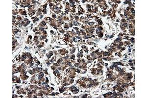 Image no. 3 for anti-Fumarylacetoacetate Hydrolase Domain Containing 2A (FAHD2A) antibody (ABIN1498184) (FAHD2A 抗体)