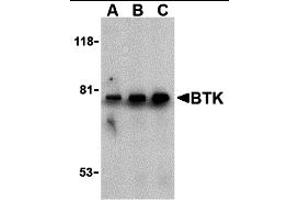 Western Blotting (WB) image for anti-Bruton Agammaglobulinemia tyrosine Kinase (BTK) (N-Term) antibody (ABIN1031284) (BTK 抗体  (N-Term))