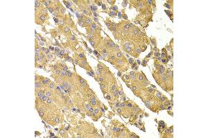 Immunohistochemistry of paraffin-embedded human stomach using PPP2CA antibody at dilution of 1:100 (x400 lens). (PPP2CA 抗体)