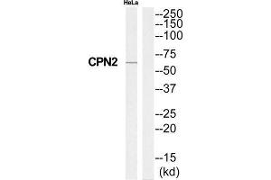 Western Blotting (WB) image for anti-Carboxypeptidase N Subunit 2 (CPN2) (C-Term) antibody (ABIN1851028) (CPN2 抗体  (C-Term))