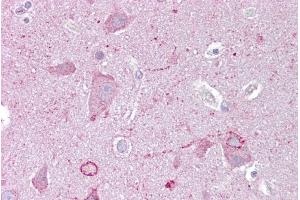 Immunohistochemistry with Brain, cortex tissue at an antibody concentration of 5µg/ml using anti-EGR3 antibody (ARP34196_P050) (EGR3 抗体  (Middle Region))