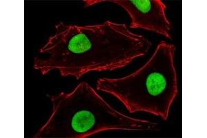 Immunofluorescence (IF) image for anti-Small Ubiquitin Related Modifier 2 (SUMO2) antibody (ABIN3032647)