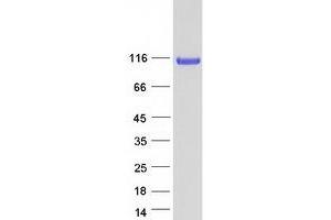 SRRT Protein (Transcript Variant 1) (Myc-DYKDDDDK Tag)