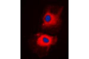 Immunofluorescent analysis of HGS staining in H1299 cells. (HGS 抗体  (Center))