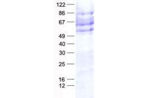 Western Blotting (WB) image for CAMP Responsive Element Binding Protein 3-Like 1 (CREB3L1) protein (His tag) (ABIN2712550)