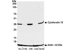 Western Blotting (WB) image for anti-Keratin 18 (KRT18) (AA 380-430) antibody (ABIN7449526)