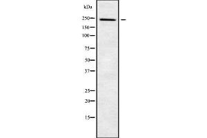 Western blot analysis NUP205 using A549 whole cell lysates (NUP205 抗体  (Internal Region))