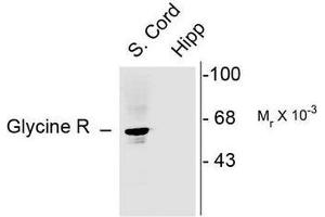 Image no. 1 for anti-Glycine Receptor, alpha 1 (GLRA1) (N-Term) antibody (ABIN372657) (GLRA1 抗体  (N-Term))