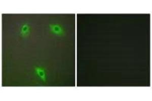 Immunofluorescence analysis of A549 cells, using KLHL3 antibody. (KLHL3 抗体  (N-Term))