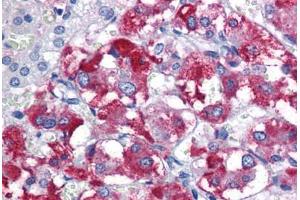 anti-Parkinson Protein 2, E3 Ubiquitin Protein Ligase (Parkin) (PARK2) (AA 311-360) antibody