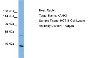Host: Rabbit Target Name: KANK1 Sample Type: HCT15 Whole Cell lysates Antibody Dilution: 1. (ANKRD15 抗体  (C-Term))