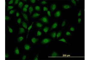 Image no. 3 for anti-Zinc Fingers and Homeoboxes 2 (ZHX2) (AA 691-789) antibody (ABIN599184) (ZHX2 抗体  (AA 691-789))