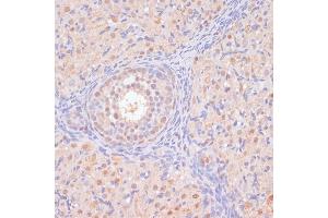 Immunohistochemistry of paraffin-embedded rat ovary using BYSL antibody (ABIN6129546, ABIN6137672, ABIN6137674 and ABIN6215553) at dilution of 1:100 (40x lens). (Bystin-Like 抗体  (AA 120-280))