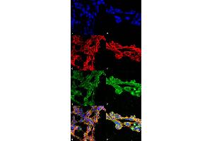 Immunocytochemistry/Immunofluorescence analysis using Mouse Anti-7-Ketocholesterol Monoclonal Antibody, Clone 7E1 . (7-Ketocholesterol (7-KC) 抗体 (APC))