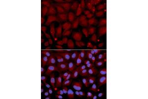 Immunofluorescence analysis of U2OS cell using BCHE antibody. (Butyrylcholinesterase 抗体  (AA 29-270))