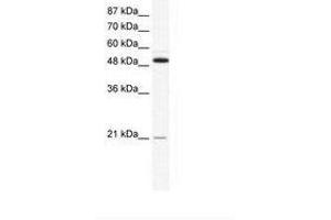 Image no. 1 for anti-Tumor Necrosis Factor Receptor Superfamily, Member 11b (TNFRSF11B) (N-Term) antibody (ABIN202431) (Osteoprotegerin 抗体  (N-Term))