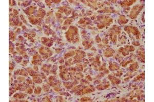 Immunohistochemistry (IHC) image for anti-ATPase, H+ Transporting, Lysosomal 70kDa, V1 Subunit A (ATP6V1A) (AA 159-405), (Catalytic Subunit A) antibody (ABIN7175225)