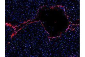 Immunofluorescence (IF) image for anti-Platelet/endothelial Cell Adhesion Molecule (PECAM1) antibody (Alexa Fluor 594) (ABIN2656826) (CD31 抗体  (Alexa Fluor 594))