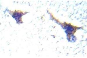 Immunohistochemistry (IHC) analyzes of PKD1/PKC-mu antibody in paraffin-embedded human brain tissue. (PKC mu 抗体)