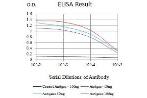 Black line: Control Antigen (100 ng),Purple line: Antigen (10 ng), Blue line: Antigen (50 ng), Red line:Antigen (100 ng) (ZAP70 抗体  (AA 169-390))