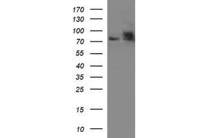 Western Blotting (WB) image for anti-Hydroxysteroid (17-Beta) Dehydrogenase 4 (HSD17B4) antibody (ABIN2715563) (HSD17B4 抗体)