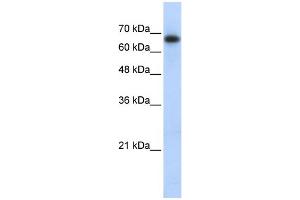 WB Suggested Anti-ZSCAN12 Antibody Titration:  0. (ZSCAN12 抗体  (Middle Region))
