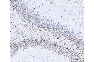IHC analysis of HnRNP H/HNRNPH1 using anti-HnRNP H/HNRNPH1 antibody (ABIN4886623). (HNRNPH1 抗体  (N-Term))