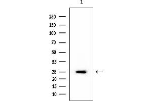 Western blot analysis of lysates from Mouse liver, using RPL14 Mouse Monoclonal Antibody at 1/1000 dilution.