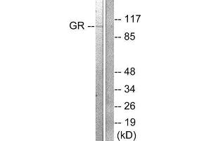 Western Blotting (WB) image for anti-GR (Internal Region), (pSer211) antibody (ABIN1847912) (GR (Internal Region), (pSer211) 抗体)