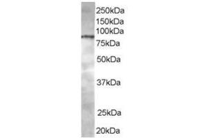 Image no. 1 for anti-ArfGAP with Coiled-Coil, Ankyrin Repeat and PH Domains 1 (ACAP1) (C-Term) antibody (ABIN374366) (ACAP1 抗体  (C-Term))