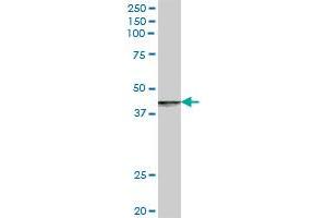 Western Blotting (WB) image for anti-Rabaptin, RAB GTPase Binding Effector Protein 2 (RABEP2) (AA 1-533) antibody (ABIN529111)