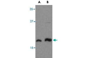 Western blot analysis of MLST8 in human brain tissue lysate with MLST8 polyclonal antibody  at (A) 1 and (B) 2 ug/mL . (GBL 抗体  (C-Term))