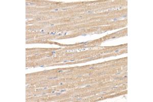 Immunohistochemistry of paraffin-embedded rat heart using SARA Rabbit mAb (ABIN7271559) at dilution of 1:50 (40x lens). (ZFYVE9 抗体)