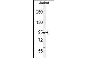 RSBN1 Antibody (N-term) (ABIN655484 and ABIN2845005) western blot analysis in Jurkat cell line lysates (35 μg/lane). (RSBN1 抗体  (N-Term))