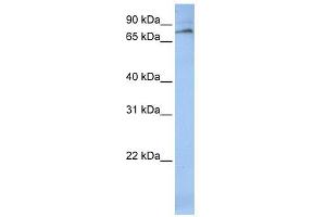 ALOX12 antibody used at 1 ug/ml to detect target protein. (ALOX12 抗体  (C-Term))