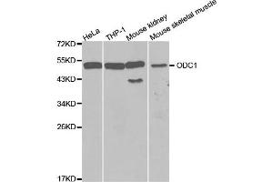 Western Blotting (WB) image for anti-Ornithine Decarboxylase 1 (ODC1) antibody (ABIN1873996) (ODC1 抗体)
