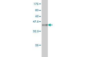 Western Blot detection against Immunogen (37. (STYK1 抗体  (AA 50-159))