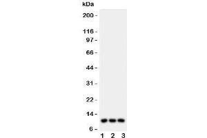 Western blot testing of CCL1 antibody and Lane 1:  U87;  2: MCF-7;  3: COLO320 lysate.