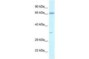 Western Blot showing Lzts1 antibody used at a concentration of 1.