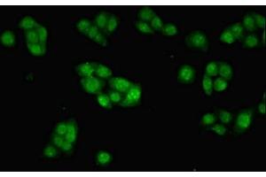 Immunofluorescent analysis of PC-3 cells using ABIN7156239 at dilution of 1:100 and Alexa Fluor 488-congugated AffiniPure Goat Anti-Rabbit IgG(H+L) (INHBB 抗体  (AA 295-405))
