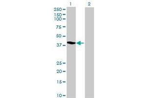 Lane 1: MRPL38 transfected lysate ( 40. (MRPL38 293T Cell Transient Overexpression Lysate(Denatured))