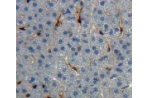Used in DAB staining on fromalin fixed paraffin-embedded liver tissue (IGF1 抗体  (AA 33-102))