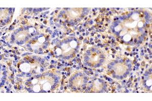 Detection of LEPR in Human Small intestine Tissue using Polyclonal Antibody to Leptin Receptor (LEPR)