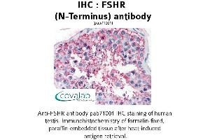 Image no. 1 for anti-Follicle Stimulating Hormone Receptor (FSHR) (Extracellular Domain), (N-Term) antibody (ABIN1734473) (FSHR 抗体  (Extracellular Domain, N-Term))