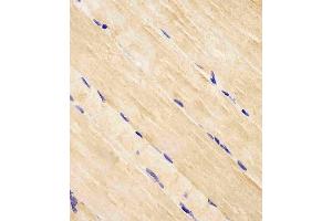 (ABIN652609 and ABIN2842407) staining RAB7 in human skeletal muscle tissue sections by Immunohistochemistry (IHC-P - paraformaldehyde-fixed, paraffin-embedded sections).