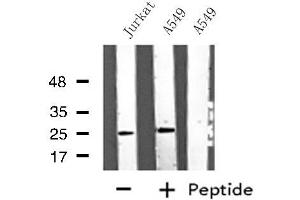 Western blot analysis of extracts from A549/Jurkat cells, using ARHGDIG antibody. (ARHGDIG 抗体  (Internal Region))