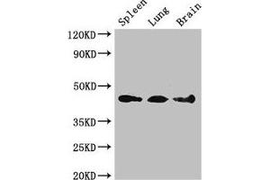 Western Blot Positive WB detected in: Mouse spleen tissue, Mouse lung tissue, Mouse brain tissue All lanes: NCF1 antibody at 3 μg/mL Secondary Goat polyclonal to rabbit IgG at 1/50000 dilution Predicted band size: 45, 31 kDa Observed band size: 45 kDa (NCF1 抗体  (AA 63-232))