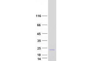Western Blotting (WB) image for Cyclin-Dependent Kinase Inhibitor 2C (p18, Inhibits CDK4) (CDKN2C) (Transcript Variant 2) protein (Myc-DYKDDDDK Tag) (ABIN2713881)
