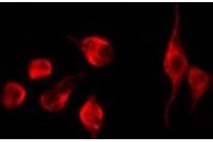 ABIN6275114 staining K562 by IF/ICC. (EPN3 抗体  (Internal Region))